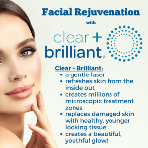 Clear + Brilliant Laser at ThrIVe Wheeling - Glowing Skin - No Downtime