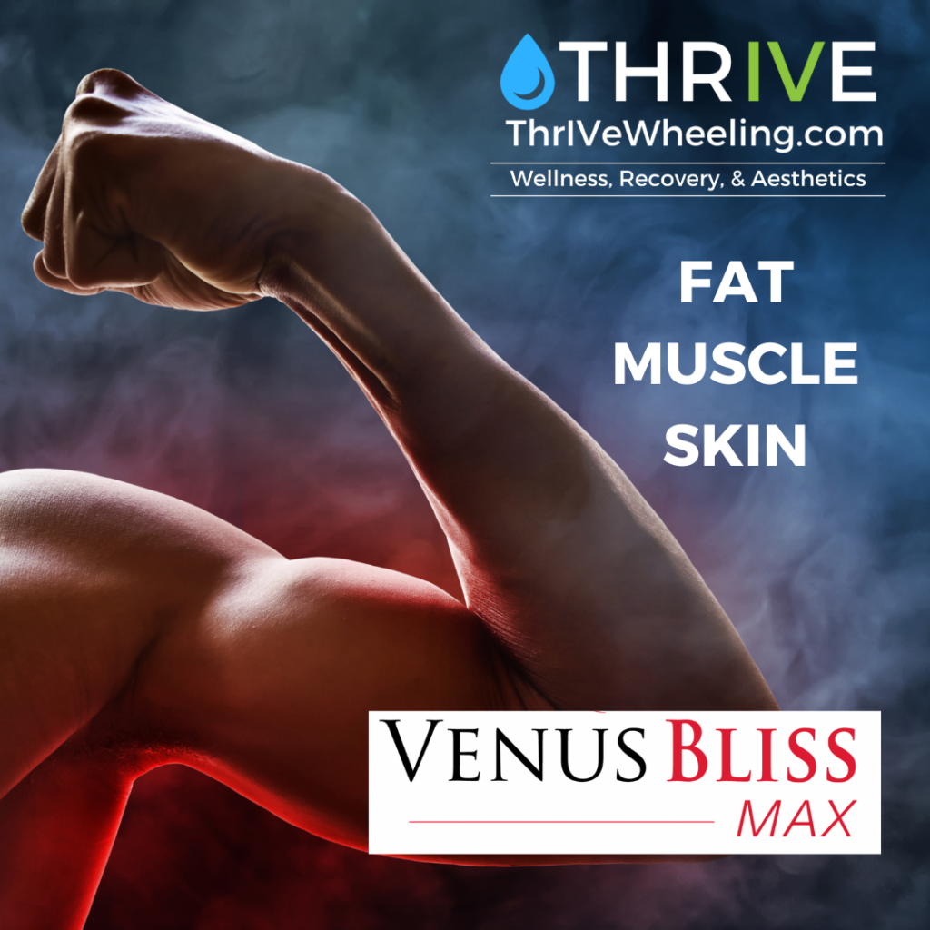 Venus Bliss MAX at ThrIVe Wheeling Body Sculpting Burn FAT - Build MUSCLE - Reduce CELLULITE & Loose Skin