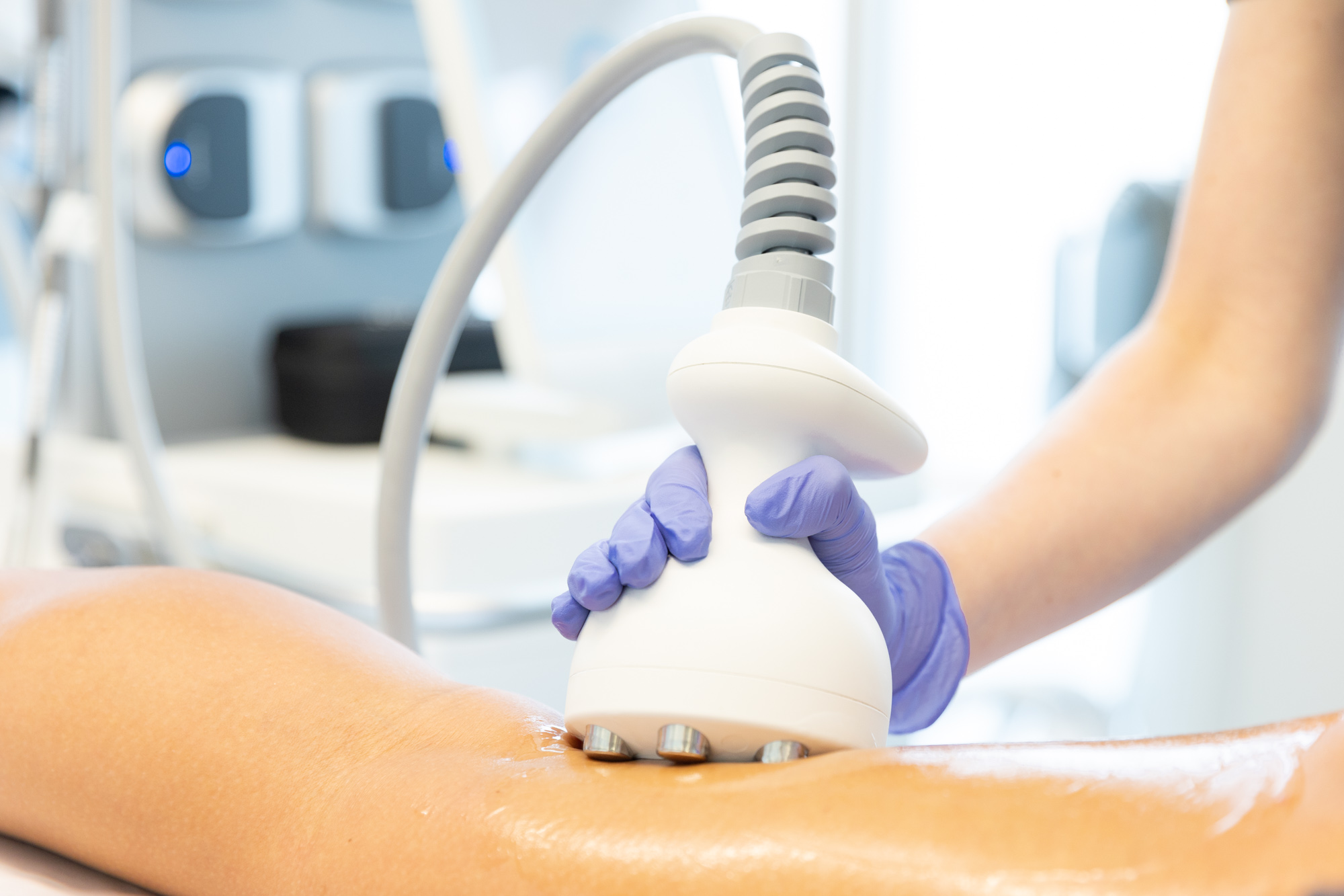 A patient gets a Venus Bliss treatment at their appointment for body contouring in Cleveland