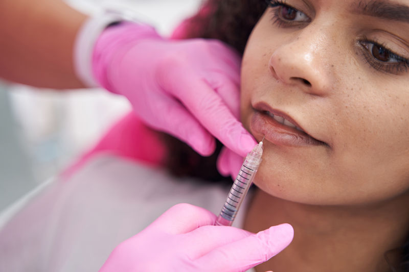 A provider, wearing surgical gloves, carefully places several units of lip filler in Wheeling in a client's lower lip. The client relaxes as she receives her injection, holding a steady expression as the fillers are placed.